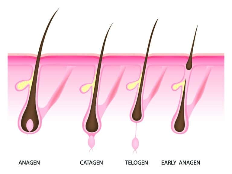 hair reduction, kelisoft, hair growth, hair development