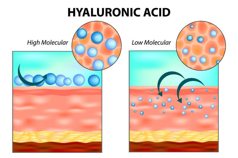Sodium Hyaluronate; Oligo Hyaluronsäure